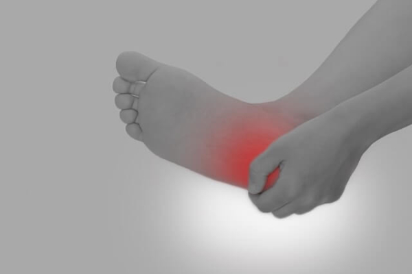 足底腱膜炎（足底筋膜炎）を改善させる方法